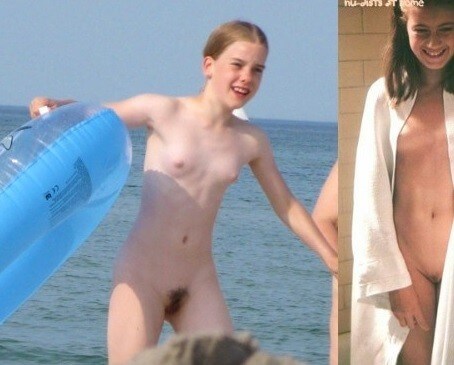 Bare Lake Days photos - Nudism helps overcome prejudices and fears